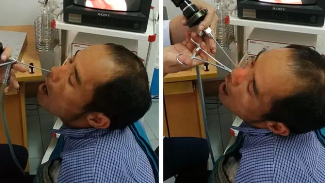 Facebook viral: acude al médico para que revisen su nariz y le descubren lo más aterrador [VIDEO]