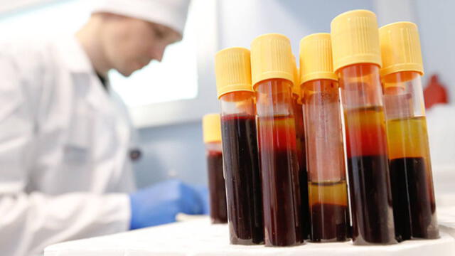 Conglomerado de salud anuncia que testará en personas vacuna contra VIH. Foto: Getty Images