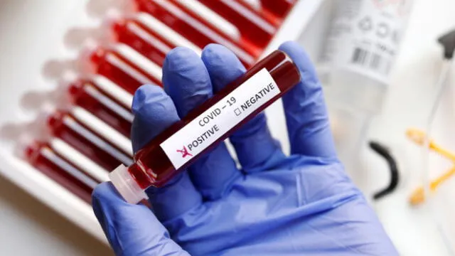 Coronavirus: diferencias entre las pruebas PCR y los test rápidos