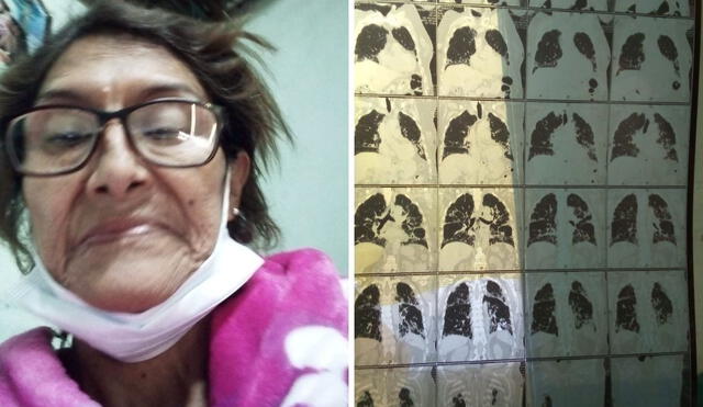 La mujer sufre de fibrosis pulmonar. Fotos: María Pía Ponce