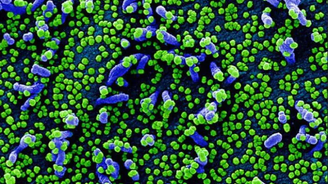 Impactantes imágenes del coronavirus atacando células humanas