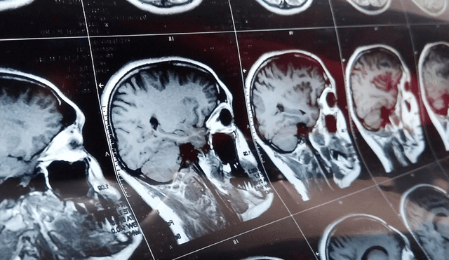 Resonancia magnética cerebral general. | Foto: Ildar Imashev