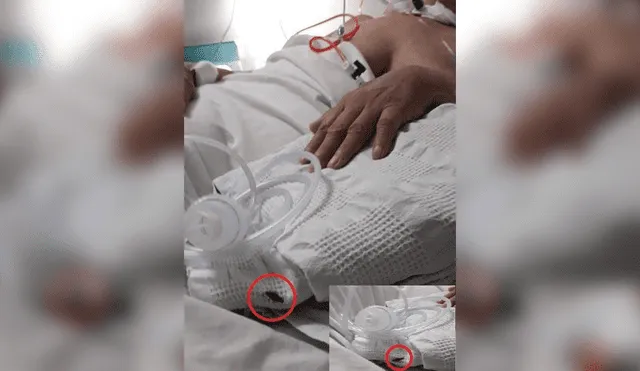 Chiclayo: denuncian que cucarachas se pasean por camas de hospital de Essalud