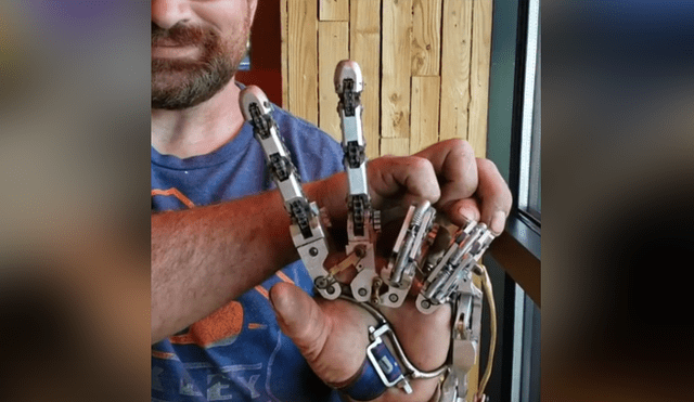 El hombre decidió hacerse una prótesis para la mano luego de que le amputaran cuatro dedos. Foto: Instagram