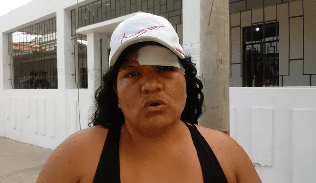 Piura: mujer desfigurada durante el Día de la Madre teme por su vida