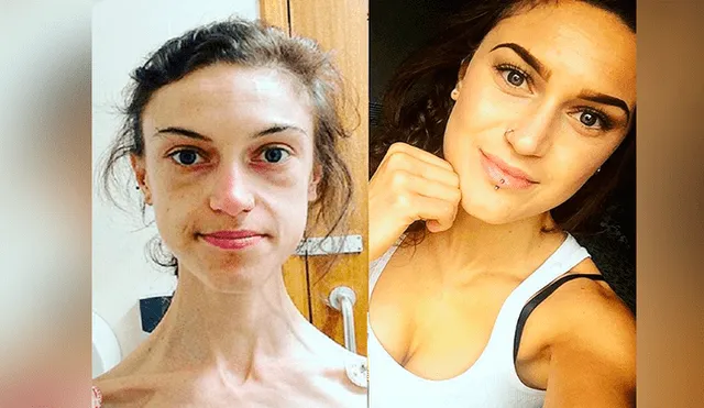 En Instagram, joven vence anorexia y su radical cambio sorprende a miles [FOTOS]