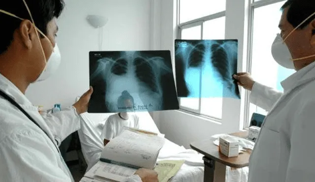 Tuberculosis: falta de personal y reactivos impiden oportuno diagnóstico