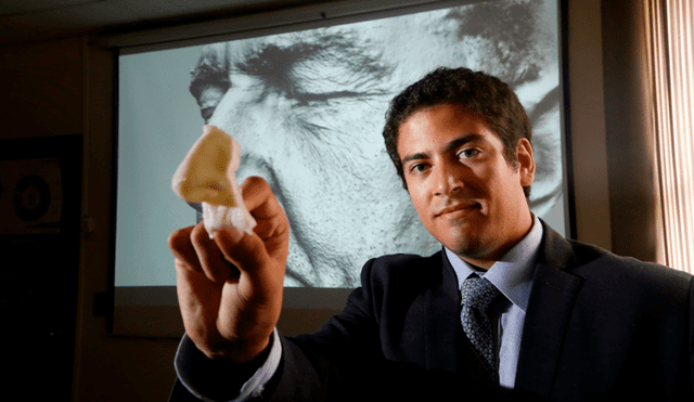 MIT premia a peruano por proyecto de prótesis facial a bajo costo