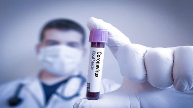 Coronavirus: ¿cuál es la diferencia entre una prueba molecular y una prueba rápida?