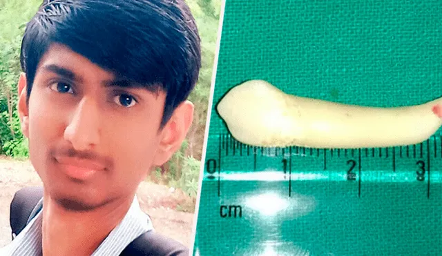 Pawan Bhavsar, fue al dentista porque sufría de hinchazón en las encías, ampollas en la boca y dolor en la mandíbula y ojos. (Foto: Difusión)