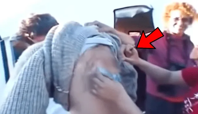Facebook viral: misteriosas criaturas vivían dentro de la espalda de un joven sin que él lo sepa [VIDEO]