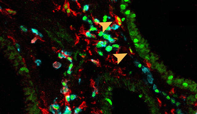 Las flechas naranjas indican la presencia de las células NAM en el pulmón. Crédito: Science Immunology.