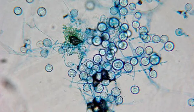 El hongo examinado fue el Aspergillus nidulans. Imagen: Difusión.