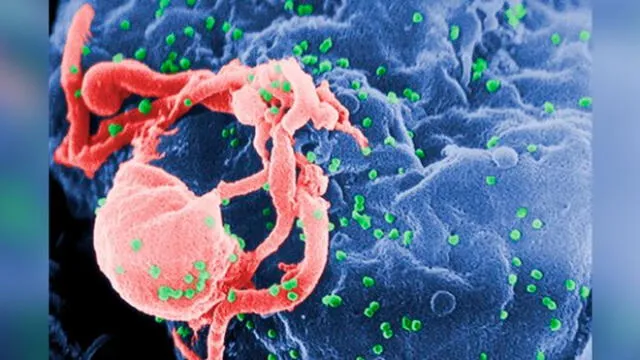 Un compuesto capaz de neutralizar al virus de la inmunodeficiencia humana (VIH). Imagen referencial: célula infectada.