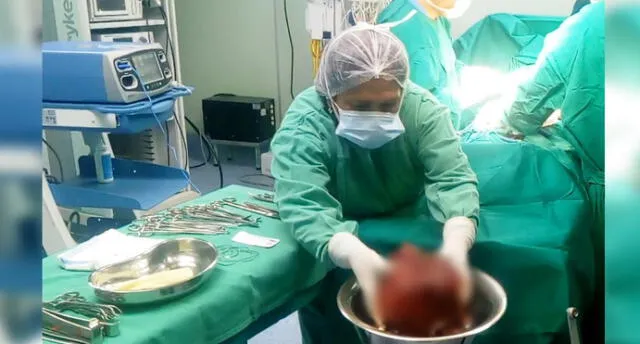 Médicos de Cusco extirpan tumor testicular gigante a sexagenario