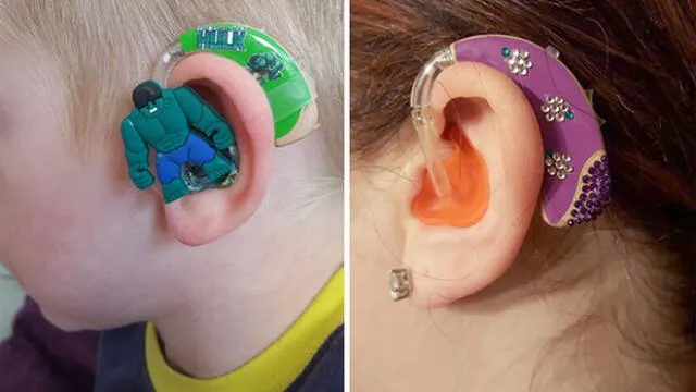 Mother to a partially deaf boy, Sarah Ivermee started selling hearing-aid decals for kids who might not otherwise be excited about wearing an earpiece.