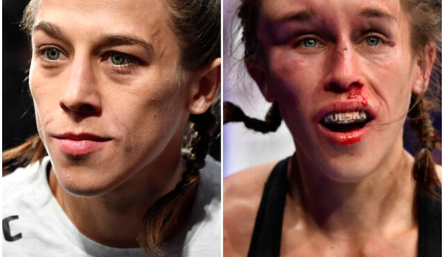 Joanna Jedrzejczyk, antes y después de la pelea.