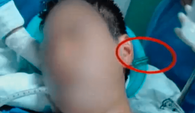 Junín: Acabó con desarmador en la cabeza tras pelea en fiesta patronal [VIDEO]