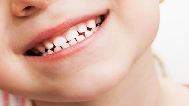 Brindarán campaña odontológica gratuita para niños de escasos recursos