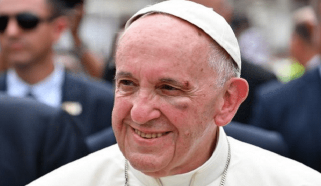 Papa Francisco bromeó sobre el golpe que sufrió en Colombia