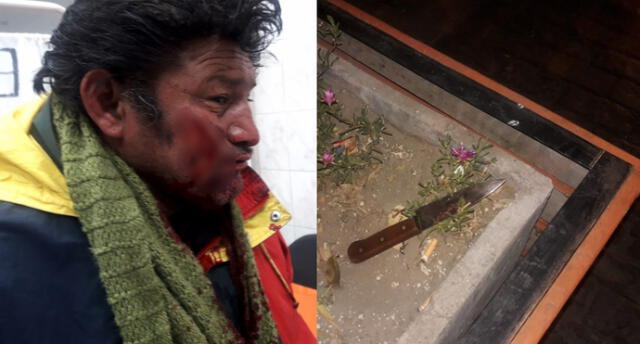 Arequipa: Colombianos atacan con cuchillo a reciclador para robarle [FOTOS]