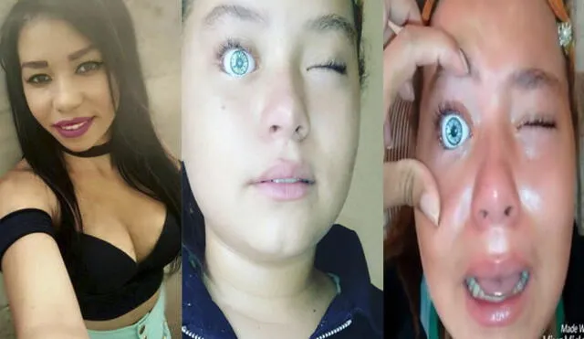 Facebook: quería tener ojos verdes, utilizó los de una muñeca, y se arrepintió al instante [VIDEO] 