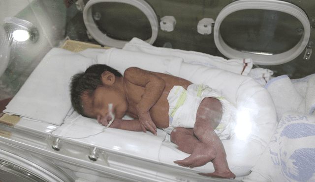 Huancayo: hospital el Carmen inaugura "soporte de nutrición parenteral" en favor de neonatales