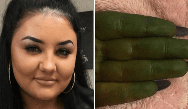 Facebook: Mujer queda verde como 'Fiona' de Shrek tras aplicarse bronceador barato [FOTOS]