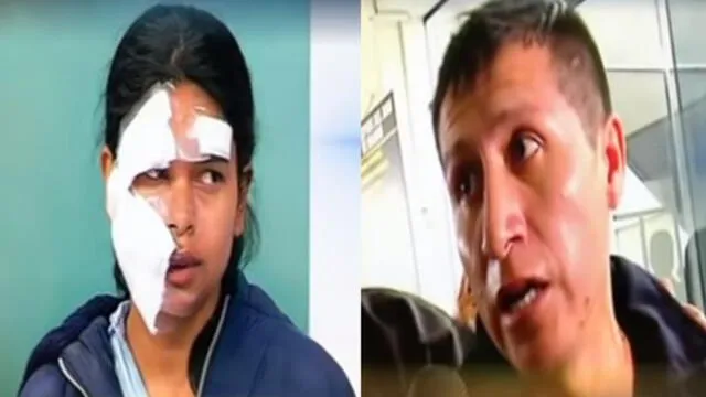 VES: lanzan bomba molotov a mujer que fue desfigurada con bisturí por expareja en un bus