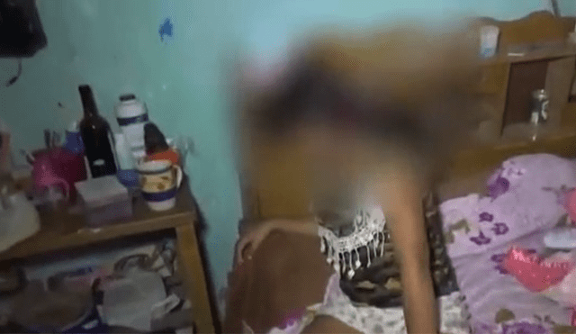 Niña de 10 años está postrada en cama tras recibir bala perdida [VIDEO]