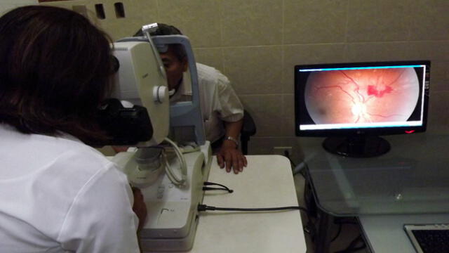 Campaña gratuita de despistaje de glaucoma