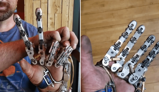 El hombre decidió hacerse una prótesis para la mano luego de que le amputaran cuatro dedos. Foto: Instagram