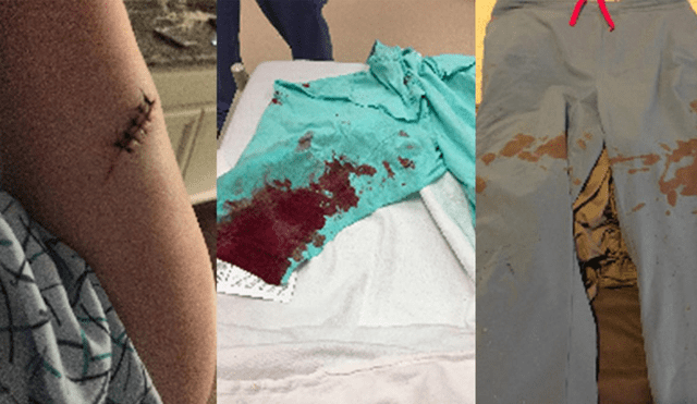 EE.UU.: enfermera inmigrante víctima de brutal agresión racista con arma blanca [VIDEO]