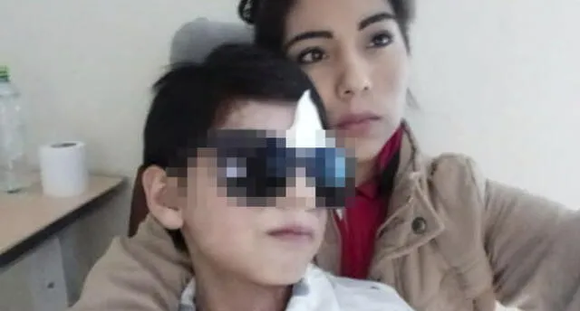 Arequipa: Piden ayuda para niño que perdió visión de un ojo por enfermedad