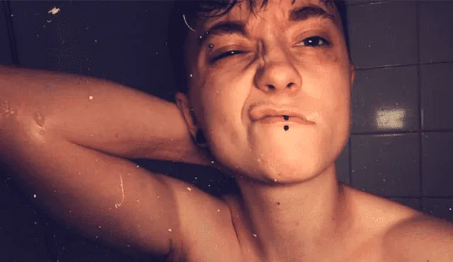 Una mujer lesbiana que fue brutalmente atacada en las calles de Inglaterra compartió fotos de sus heridas para crear conciencia sobre la realidad de la homofobia en la actualidad.