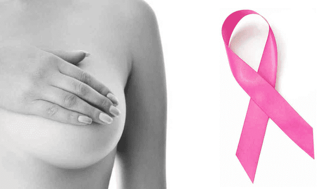 Del 2007 al 2019 se tiene registro de 2.256 casos de cáncer de mama. Foto: La República