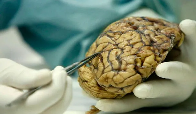 La materia gris del cerebro es vital para procesar información en el cerebro. Foto: EFE.