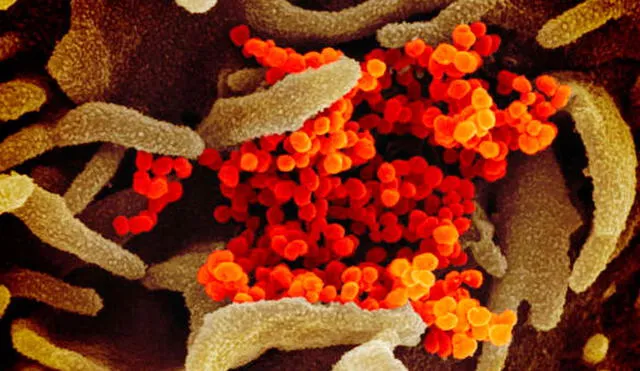 Imagen de microscopio electrónico que muestra al SARS-CoV-2 aislado de un paciente en EE. UU. Crédito: NIAID.