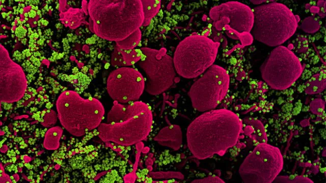 Imagen microscópica del SARS-CoV-2. El virus entra sigilosamente a las células humanas. Foto: Instituto Nacional de Alergias y Enfermedades Infecciosas (NIAID)