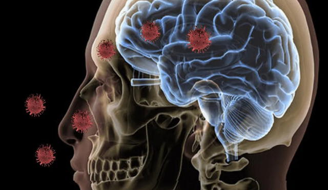 Investigadores de la Universidad de Londres habían afirmado que el cerebro de una persona contagiada del nuevo coronavirus envejece 10 años. Foto: La verdad noticias / Estudio Foto Science