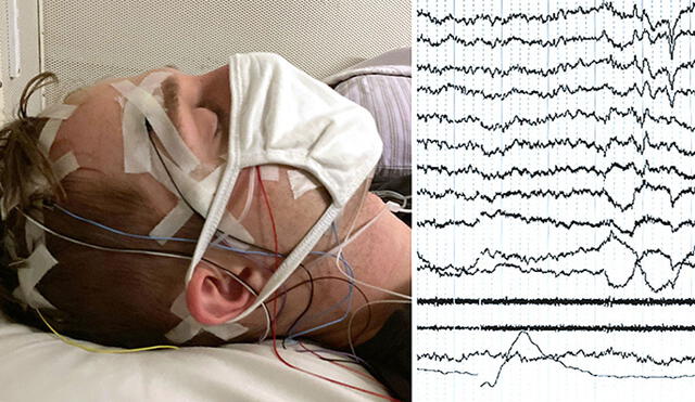 Paciente dormido en laboratorio. A la derecha, sus señales cerebrales y oculares. Foto: K. Kokonly