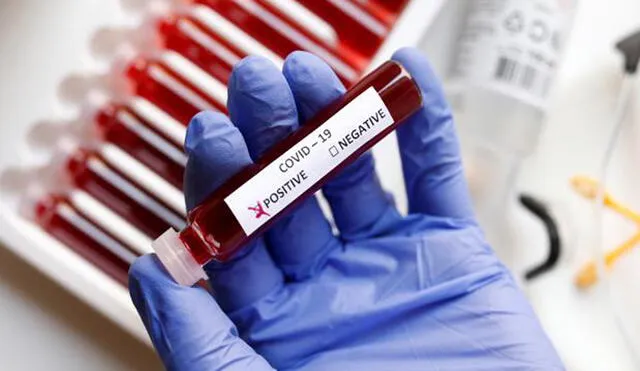 El tipo de sangre A tiene vínculo físico con el coronavirus, pero las investigaciones aún no son conclusivas. Foto: ABC