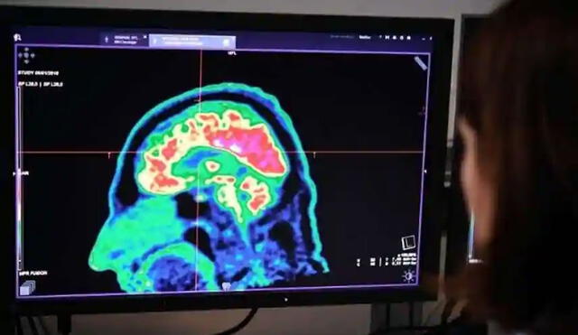 Una imagen de un cerebro humano tomada por un escáner de tomografía TEP. Foto: AFP