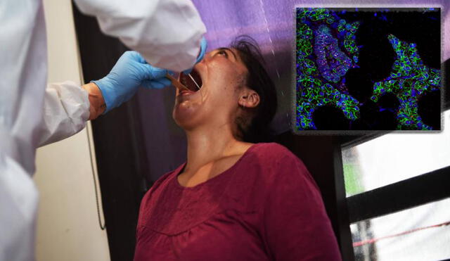Las manifestaciones orales del coronavirus son evidentes en casi la mitad de los casos de contagios. Foto: Composición / AFP / NIDCR