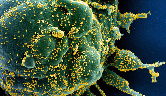 Partículas de coronavirus SARS-CoV-2 salen de una célula infectada. Foto: CDC