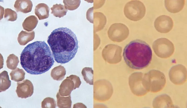 Imágenes en microscopio de dos monocitos (izquierda) y un linfocito (derecha) rodeados de glóbulos rojos. Fotos: Graham Beards/ NicolasGrandjean