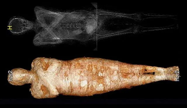 Imagen en rayos X de la momia embarazada. La mujer murió entre los 20 y 30 años de edad junto al feto entre las semanas 26 y 30 del embarazo, según estudio. Foto: AFP