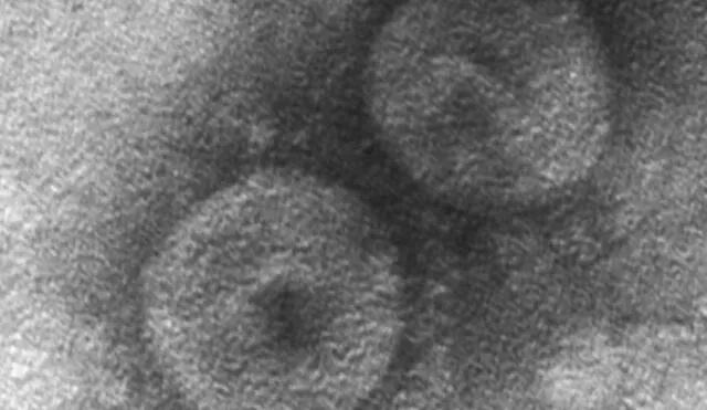 El coronavirus descubierto fue identificado como CCoV-HuPn-2018. Foto: Universidad de Ohio