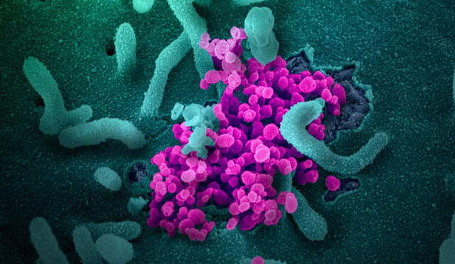 Partículas de SARS-CoV-2 emergen de una célula infectada después de haberse multiplicado. Foto: NIAiD