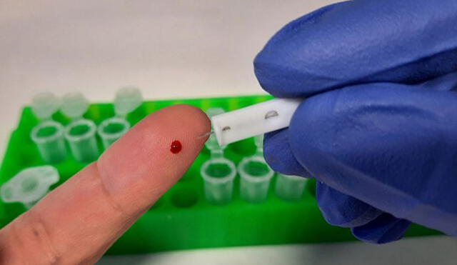 El nuevo test de anticuerpos contra el SARS-CoV-2 requiere solo una gota de sangre extraída del dedo. Foto referencial: difusión